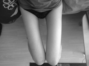 psicologos thigh gap malaga
