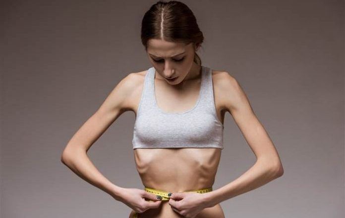 anorexia nerviosa